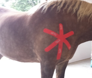 Space correction to relieve inflammation after a shoulder contusion
