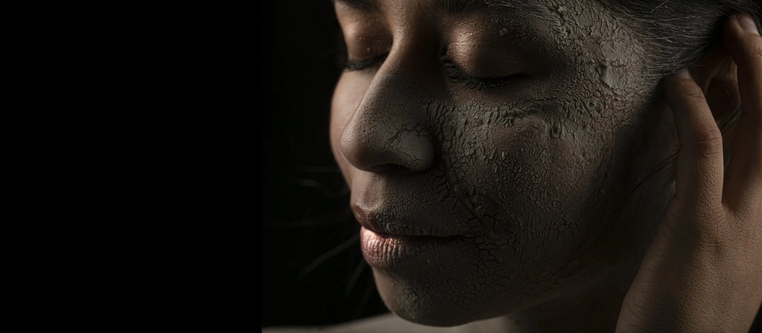 Close-up of a person's face with very dry, cracked skin, eyes closed, hand gently touching the side of their face.