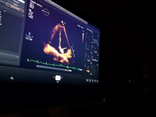 This is the image of Rima's heart during the echocardiogram