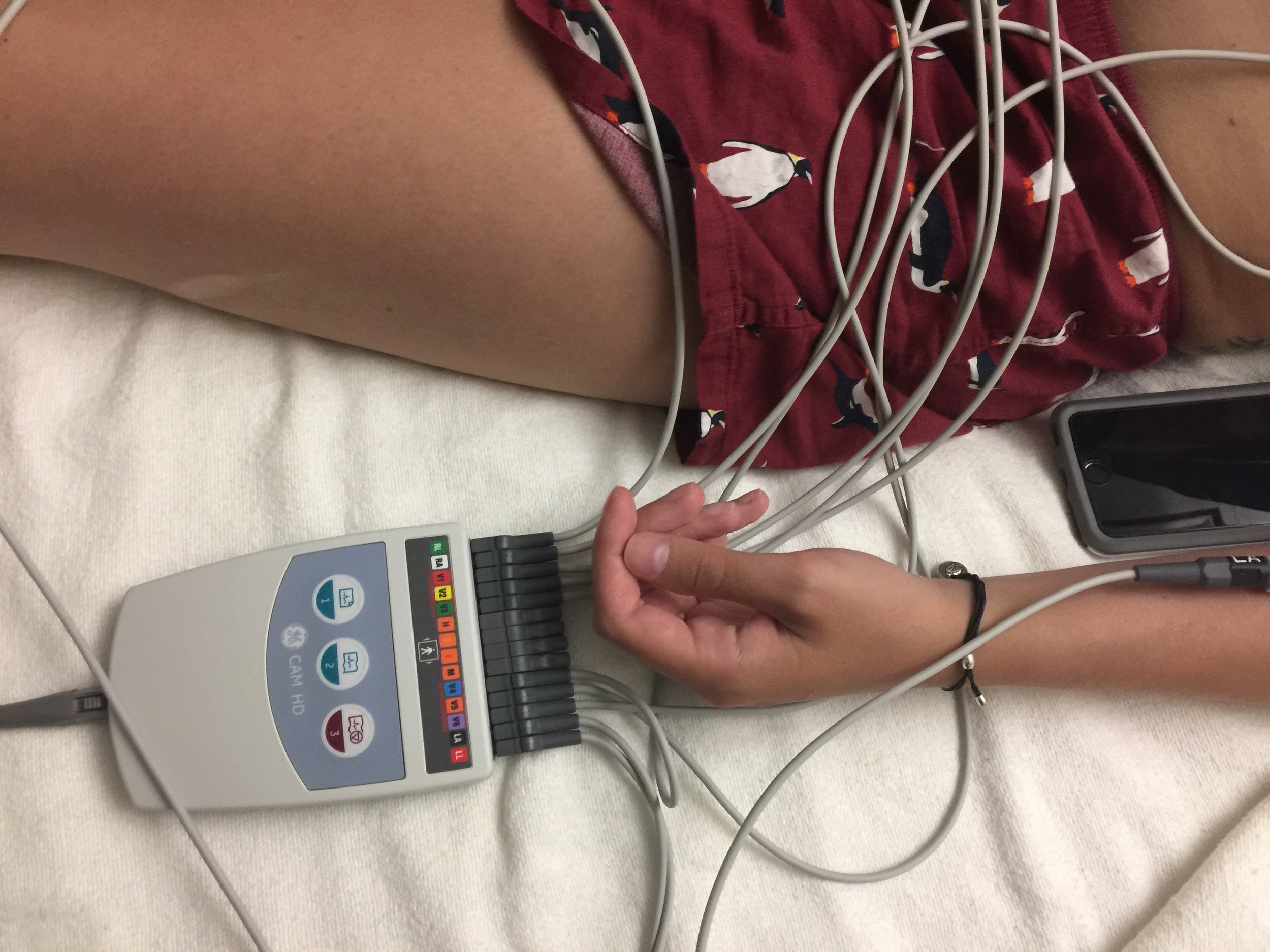 EKG