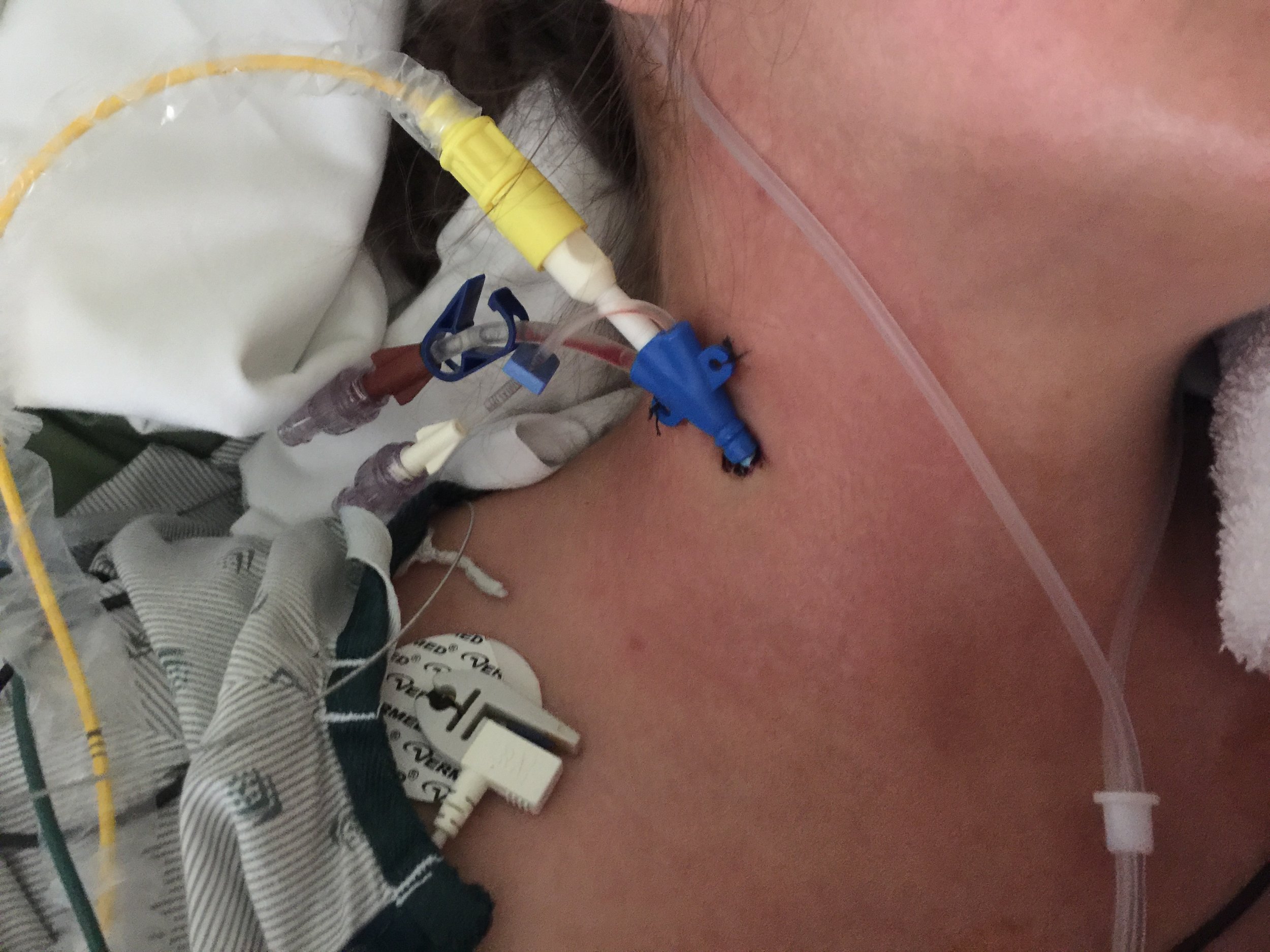 close up of the swan and stitches before it was pulled out 
