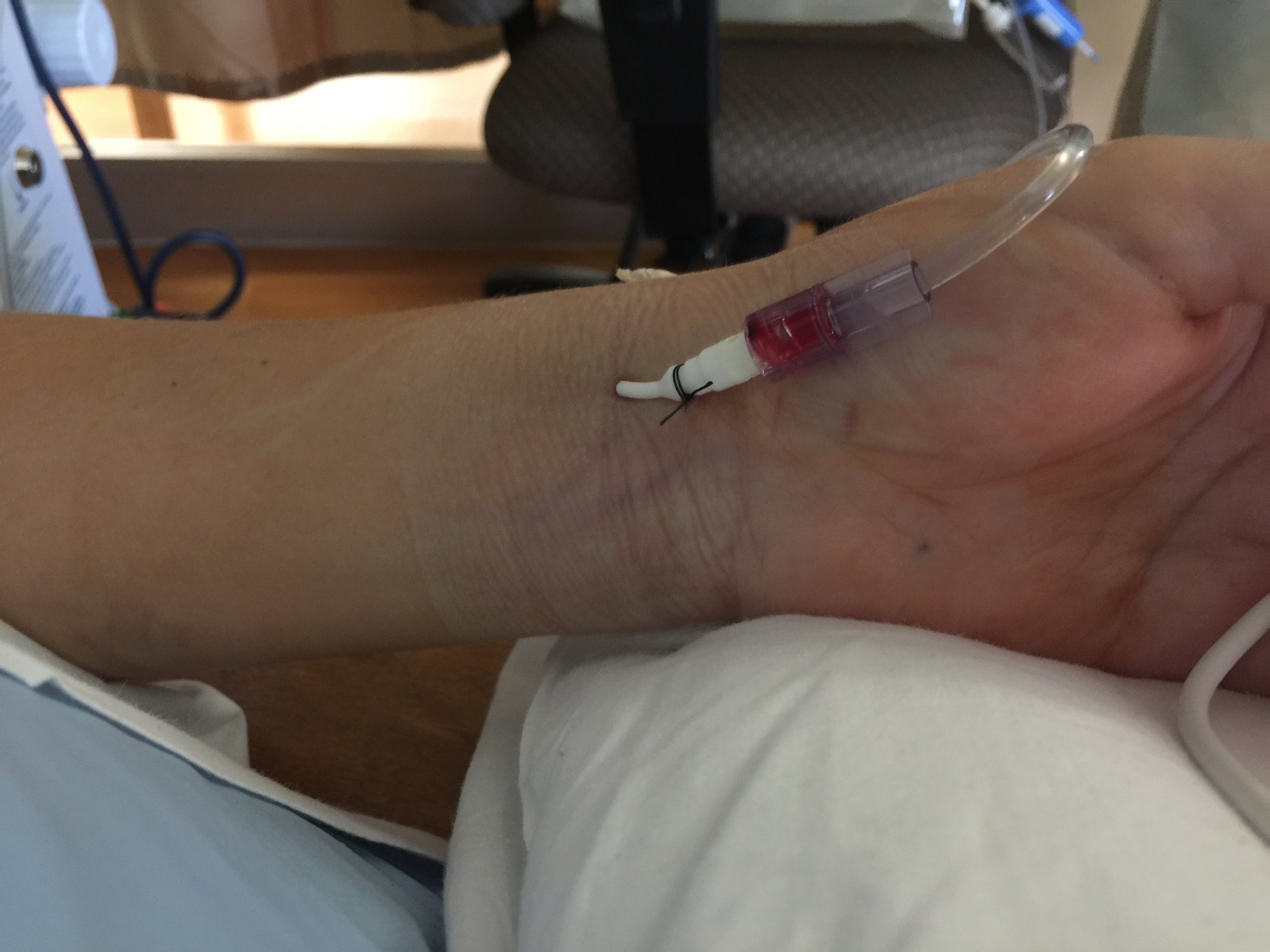 arterial iv