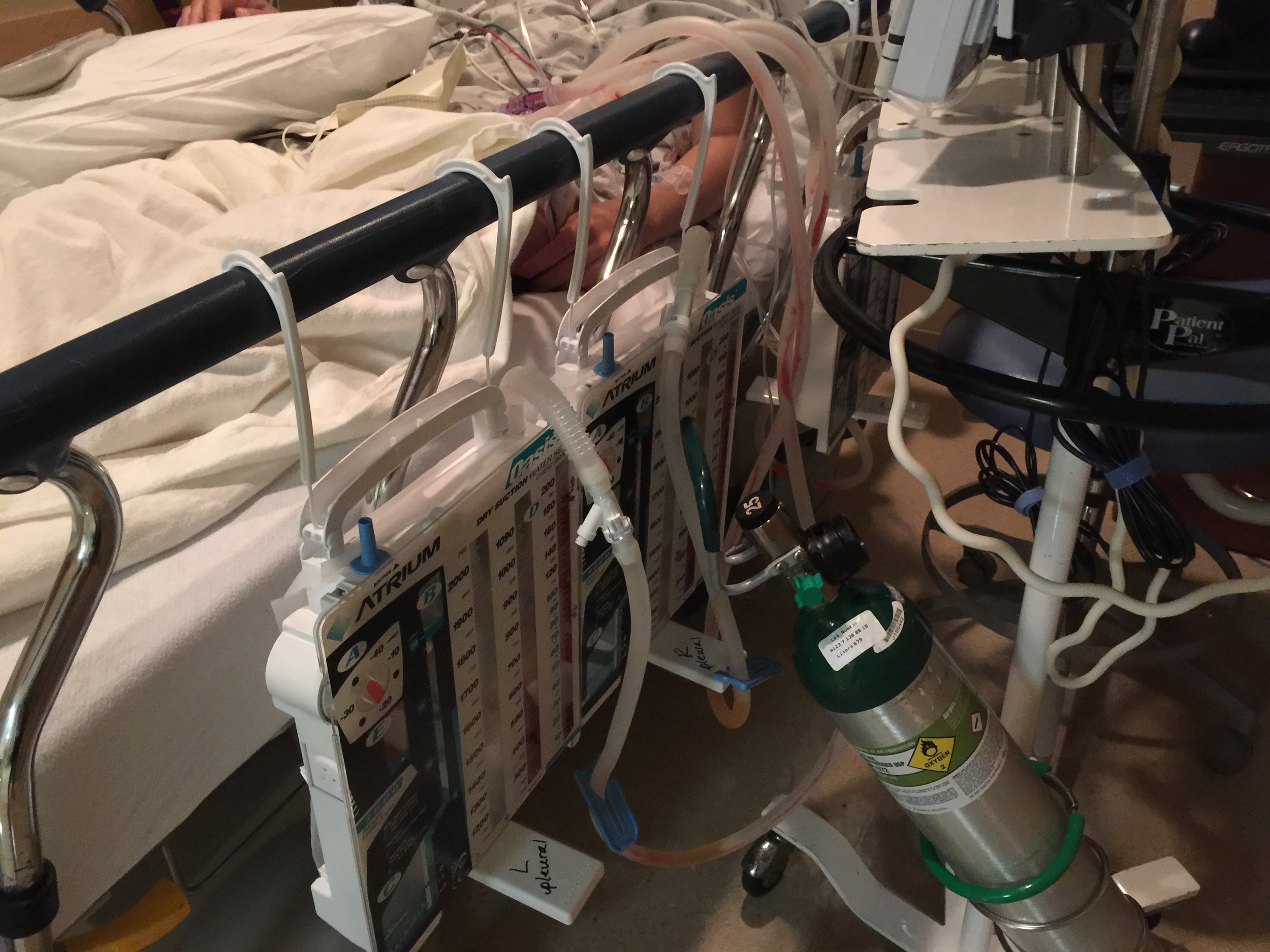 tubes 