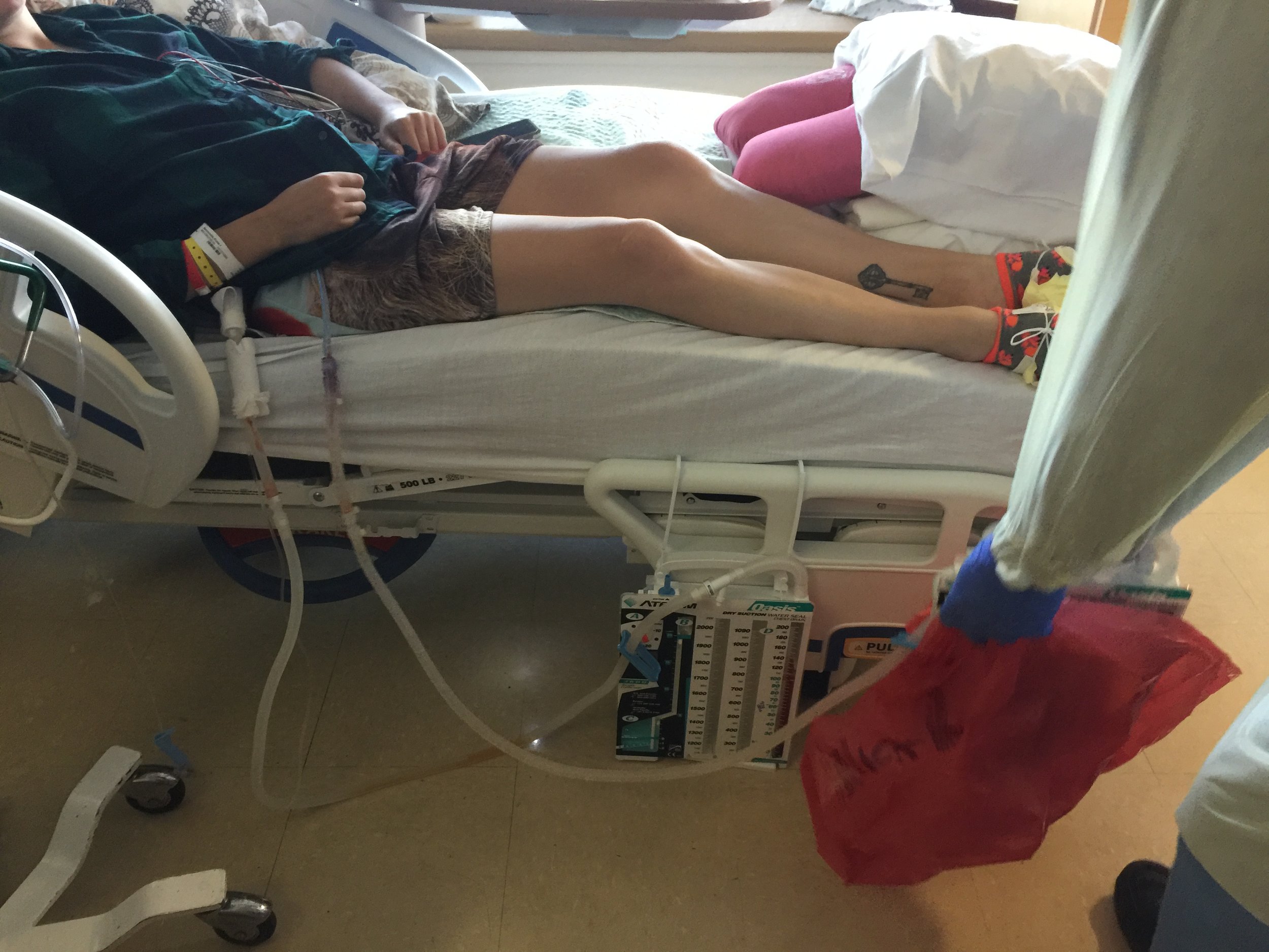 taking away the chest fluid collectors 