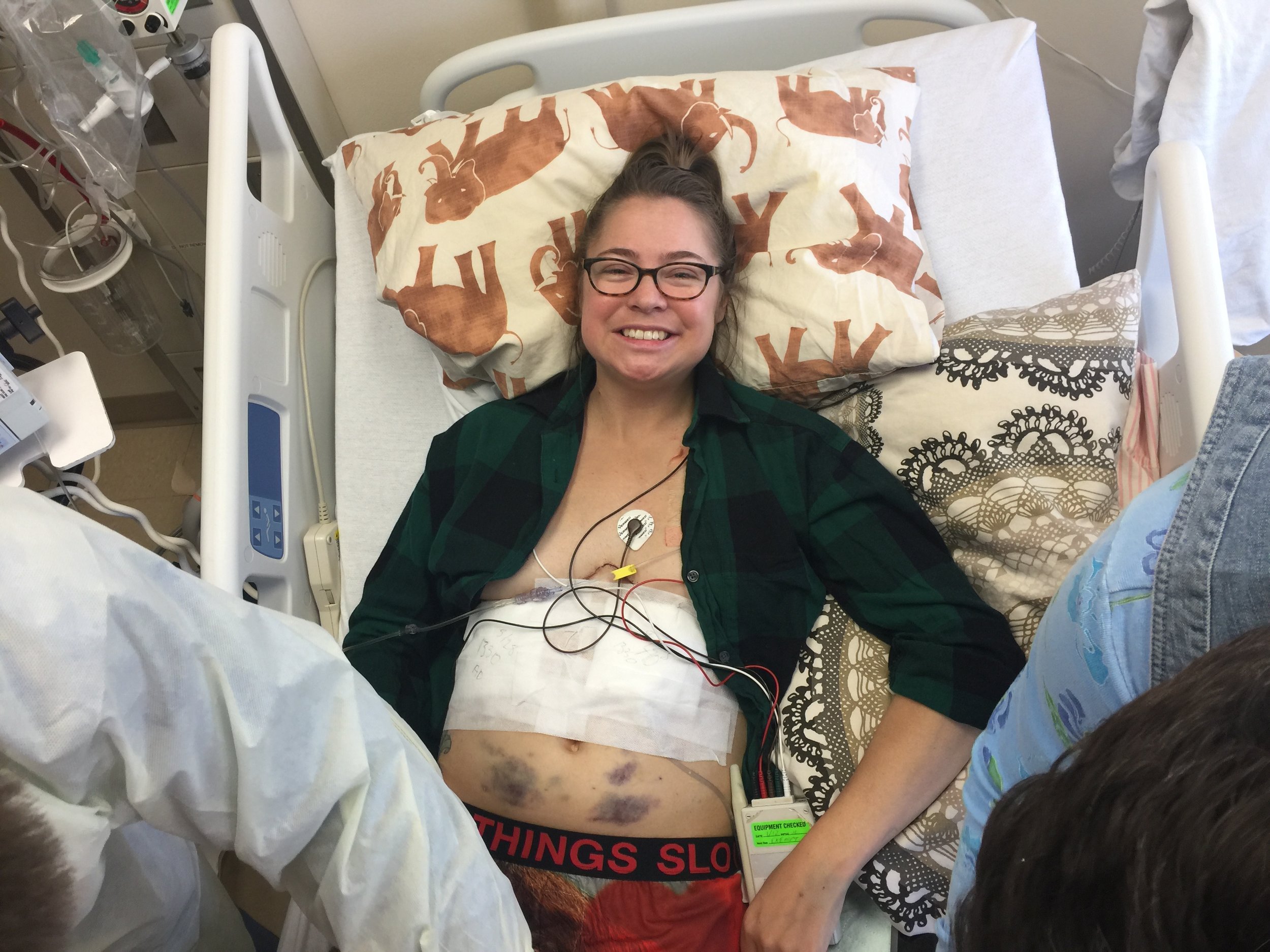 Chest tube FREE