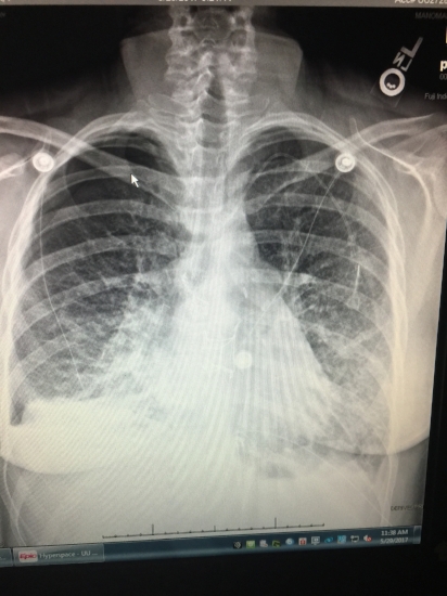 X-ray looking better and better each day! 