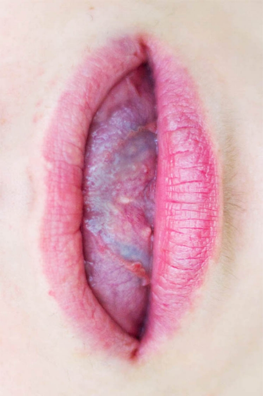 Vulva