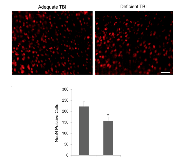 Photo Source: Desai A, Kevala K, Kim H-Y (2014) Depletion of Brain Docosahexaenoic Acid Impairs Recovery from Traumatic Brain Injury. PLoS ONE 9(1): e86472. https://doi.org/10.1371/journal.pone.0086472