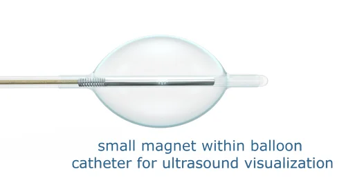 IBC-Balloon-explained.jpg