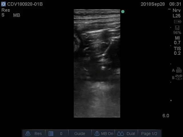 Needle Confirmation IP.jpg