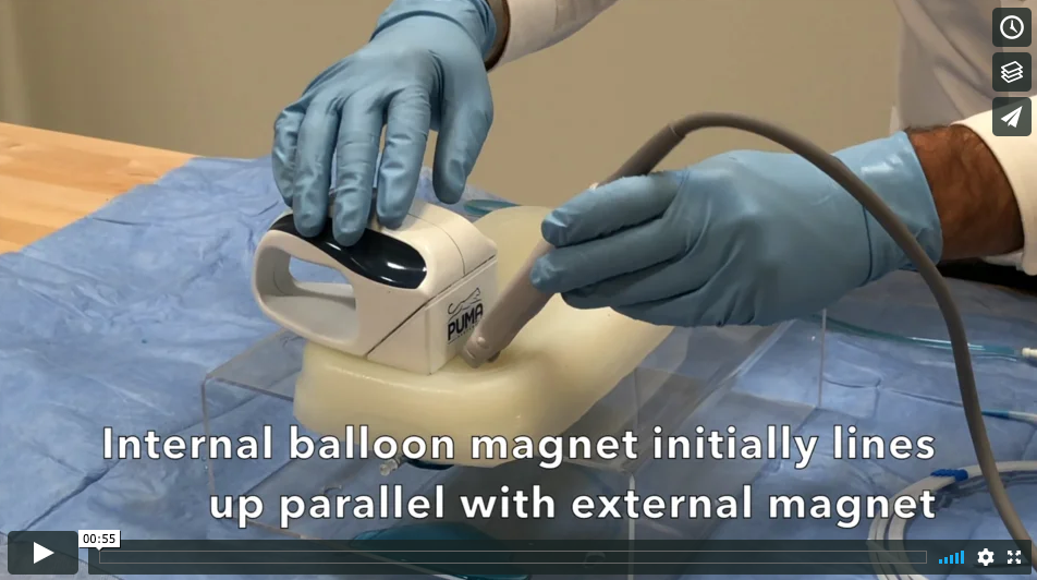 Short video of a technique to gain another approach angle for PUG (percutaneous ultrasound gastrostomy). This 90' turn provides another visualization tool and helps confirm balloon. 