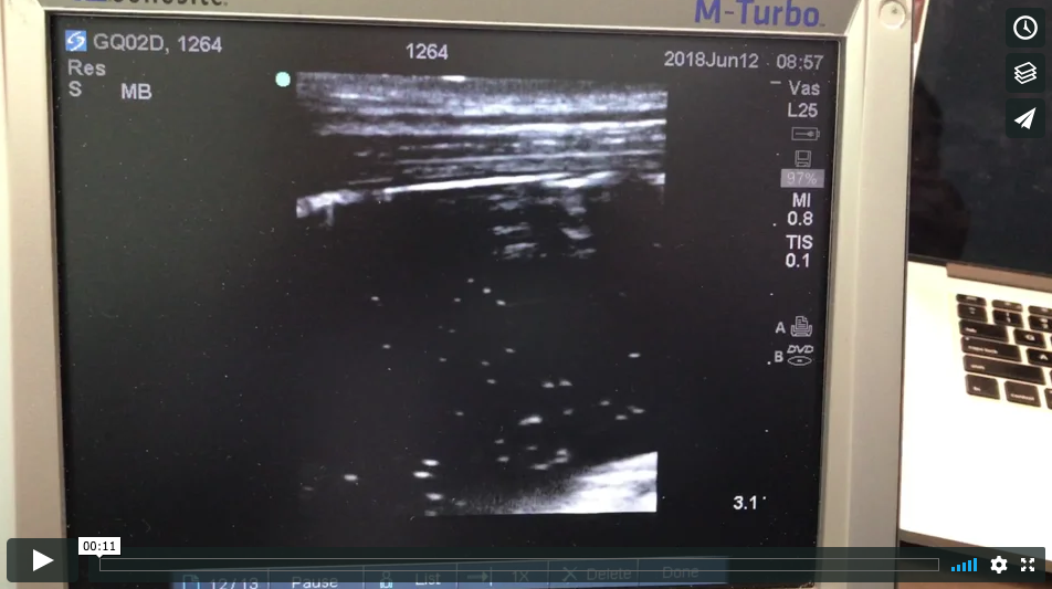 &nbsp;Microbubbles in Balloon - Canine POCUS Clip