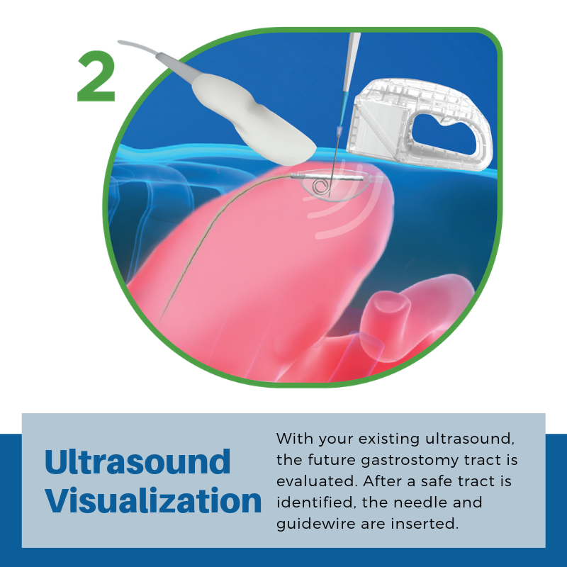 PUG Step 2: Ultrasound Visualization