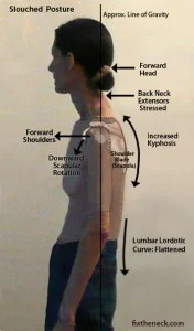 kephotic_posture_side-176x300.jpg
