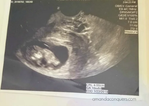 babes at 10 weeks.jpg