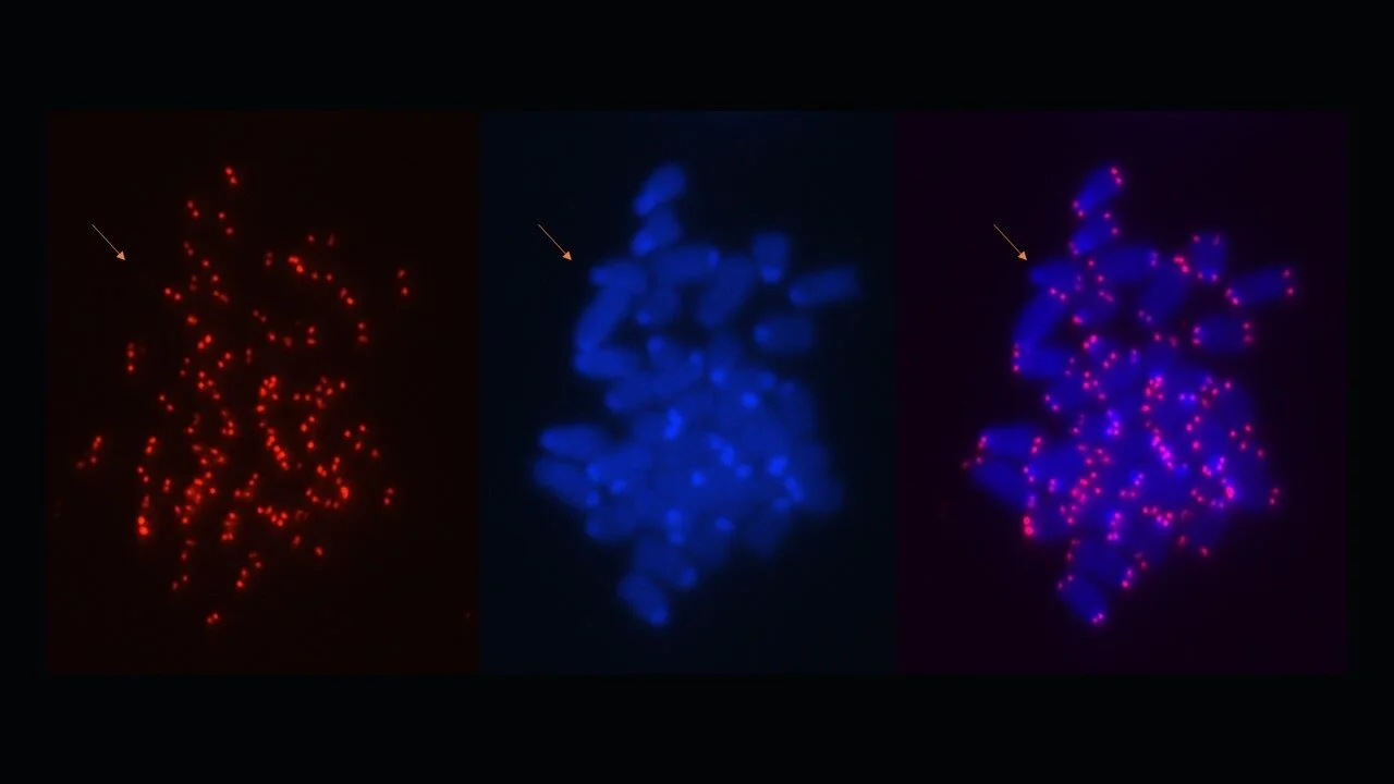 Metaphase.jpg