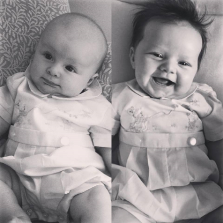 LEFT: Will at 10 weeks. RIGHT: His cousin Stephen in the same outfit at 10 weeks... one year ago before his surgery.