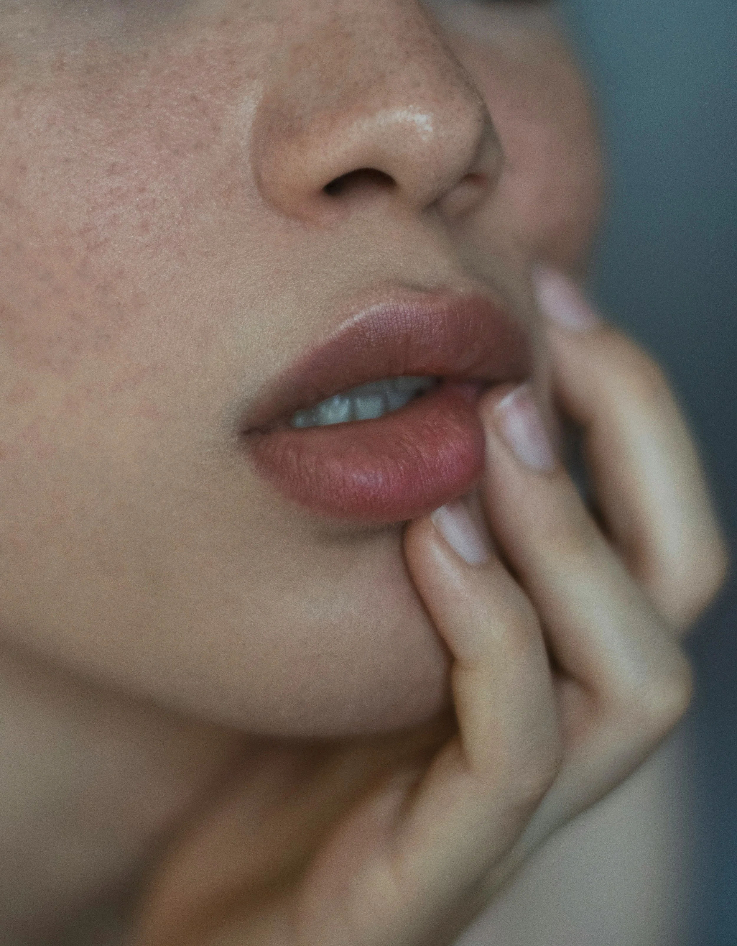 Chinese herbal medicine for acne Melbourne