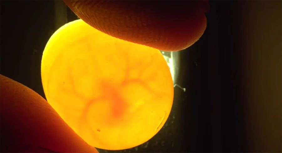 Resurrection Monday: Lift up life!