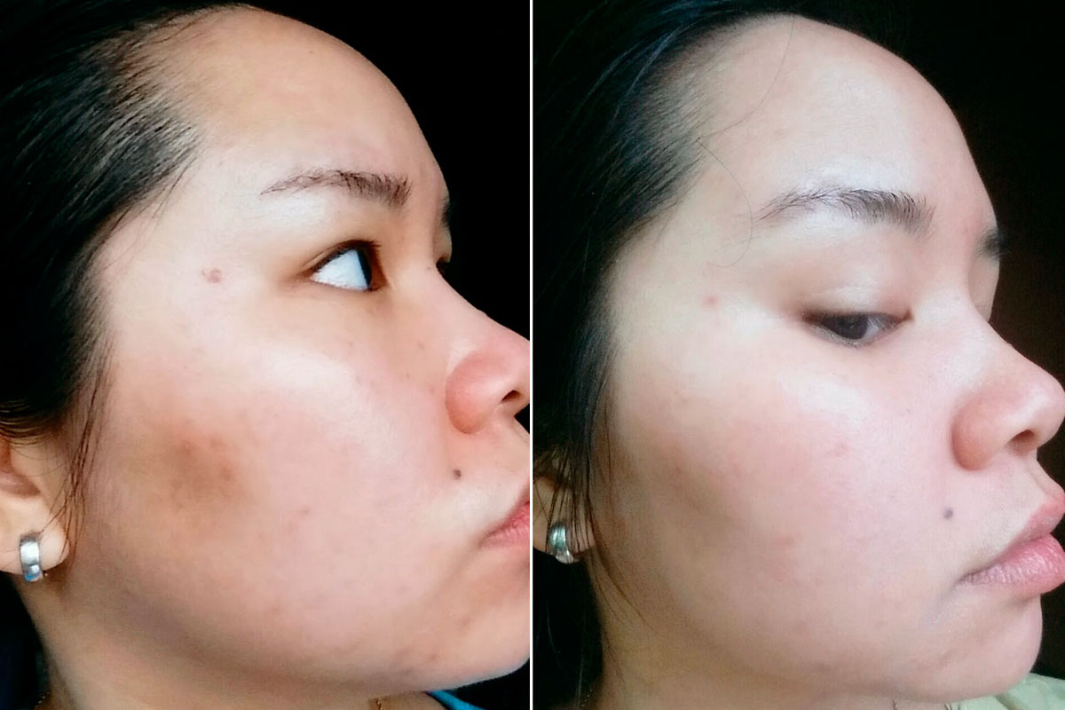 El antes y el después. Imagen de www.holysnails.com