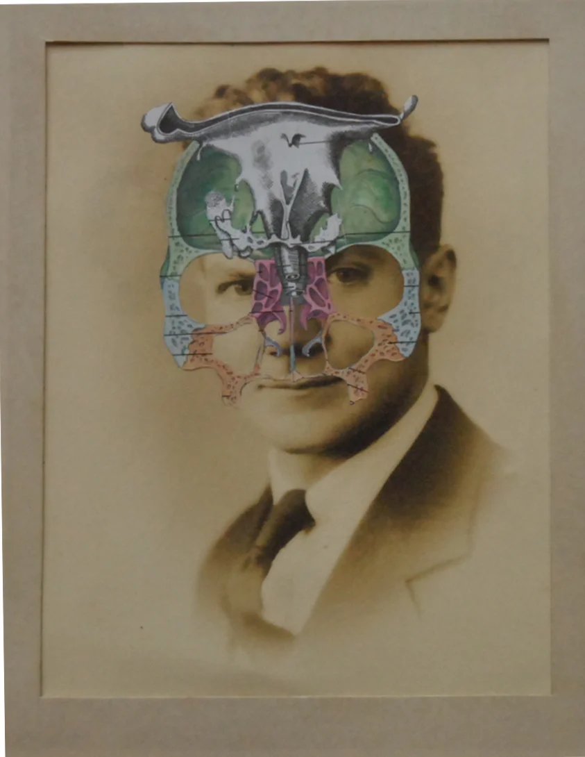 Homo in Larvam