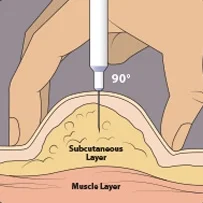 hcg pinch injection.jpg