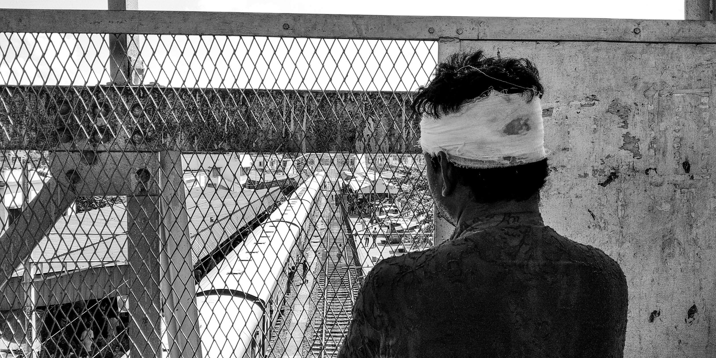  A Patient (Head injury) is waiting for his train at the railway over bridge. Date: 29 June, 2019  Location: Krishnanagar, West Bengal 741101, India 