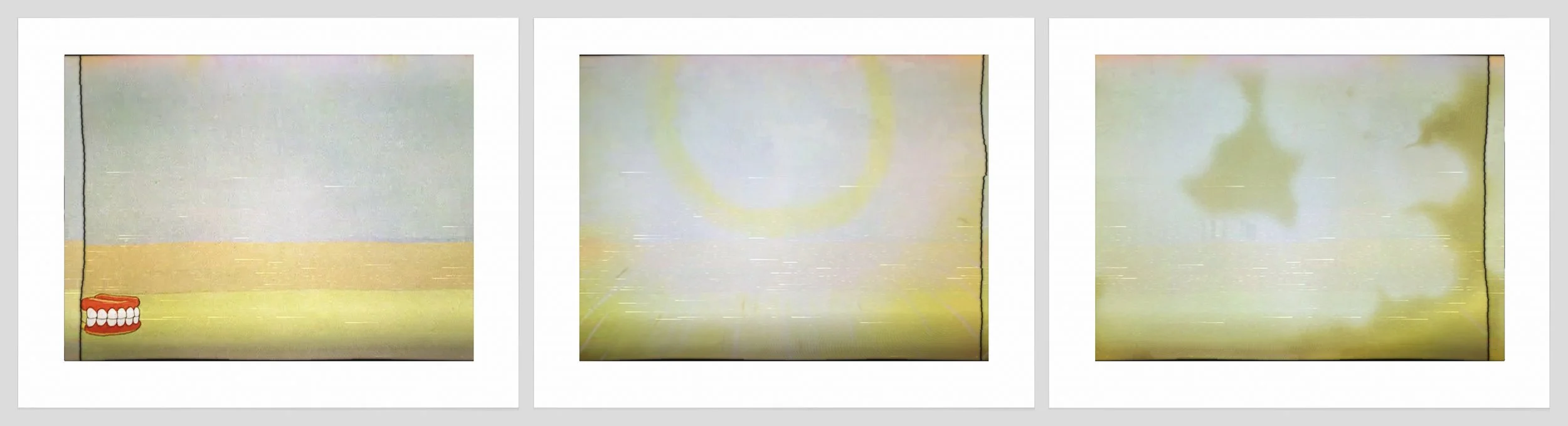 1479 a, b, c. Dentures.jpg