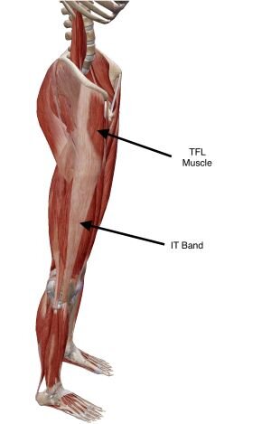 Tight it band lower back pain hotsell