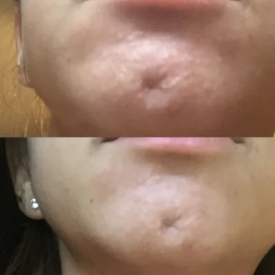 Before/After with better lighting...