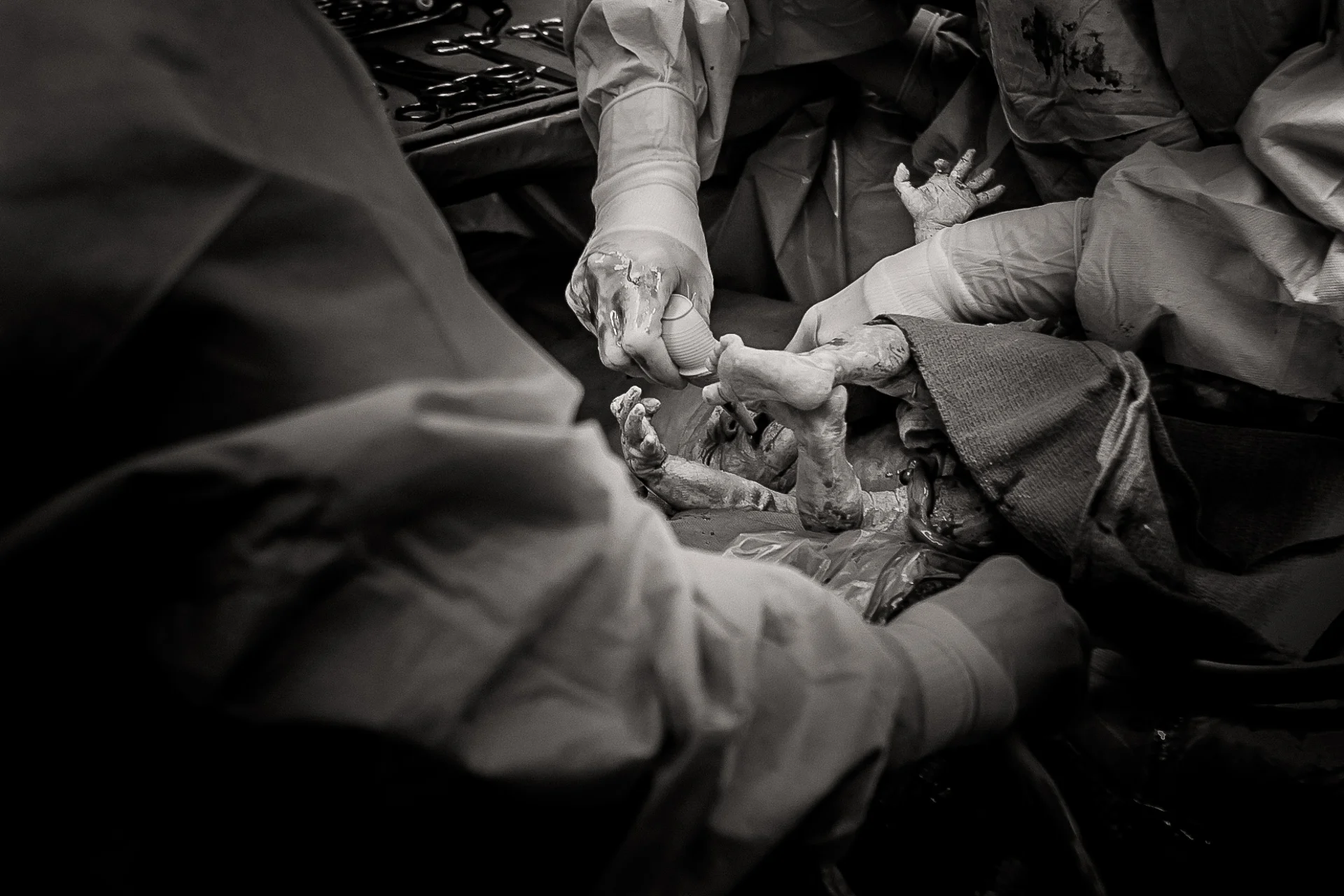 Tulsa-Cesarean-Birth-Photography-by-Micah-Lynn-Birth-STories.jpg