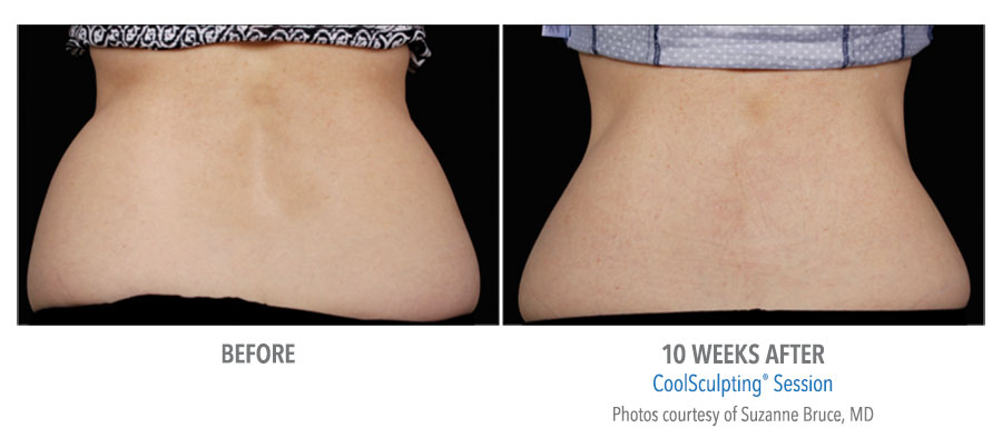 ABOVE: Females are sculpted with the ideal hourglass shape in mind BELOW: Males are sculpted with the classic V-shape in mind