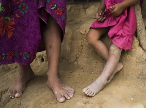 To the Rohingya Woman Who Showed Me Her Bullet Wound