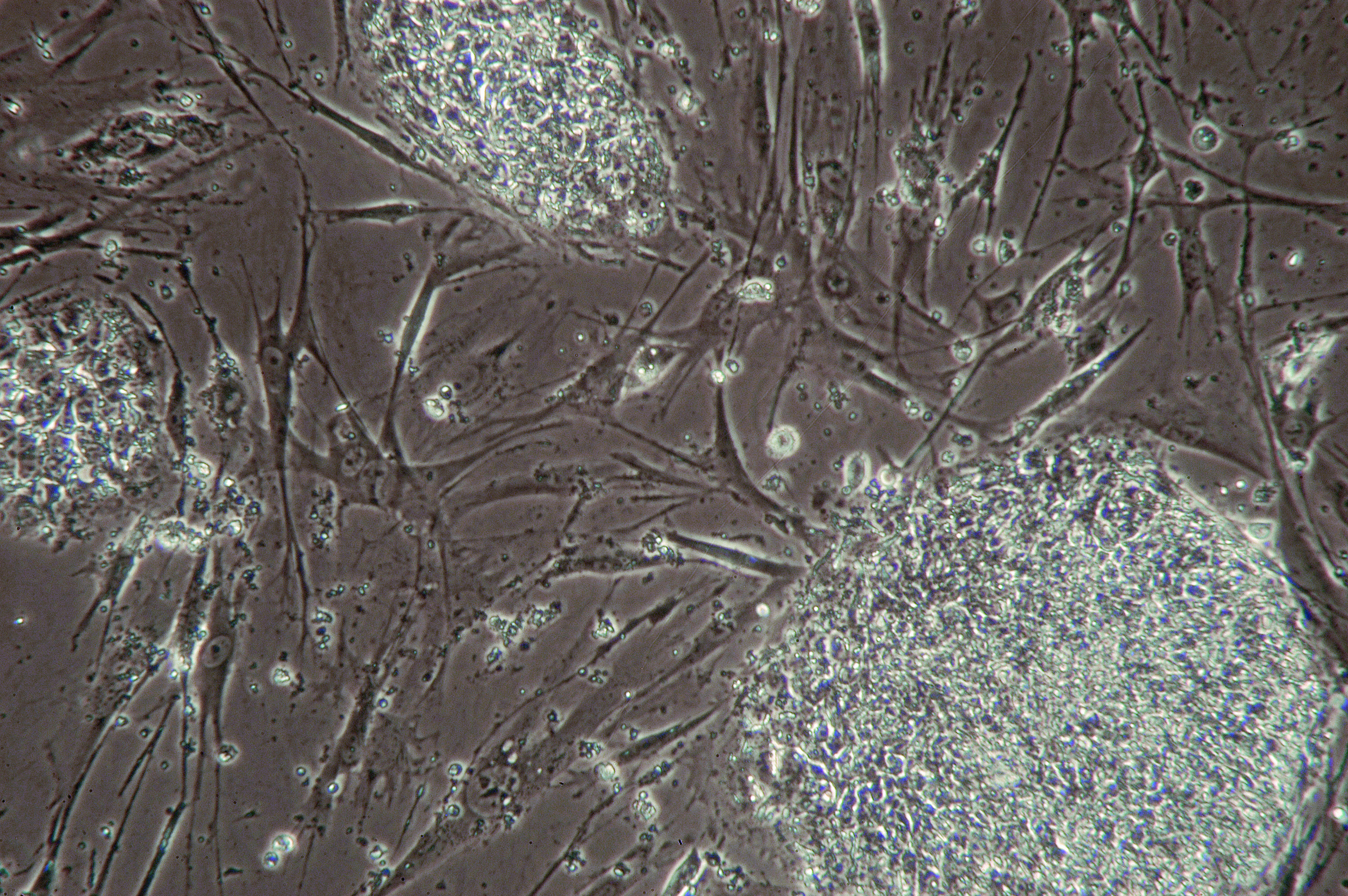 I am fascinated by the dual feelings that strike me when I look at these images—attachment and repulsion, warmth and cold, sameness and difference, filth and sterility. The surfaces of cells in microscope images can seem almost impossibly foreign t