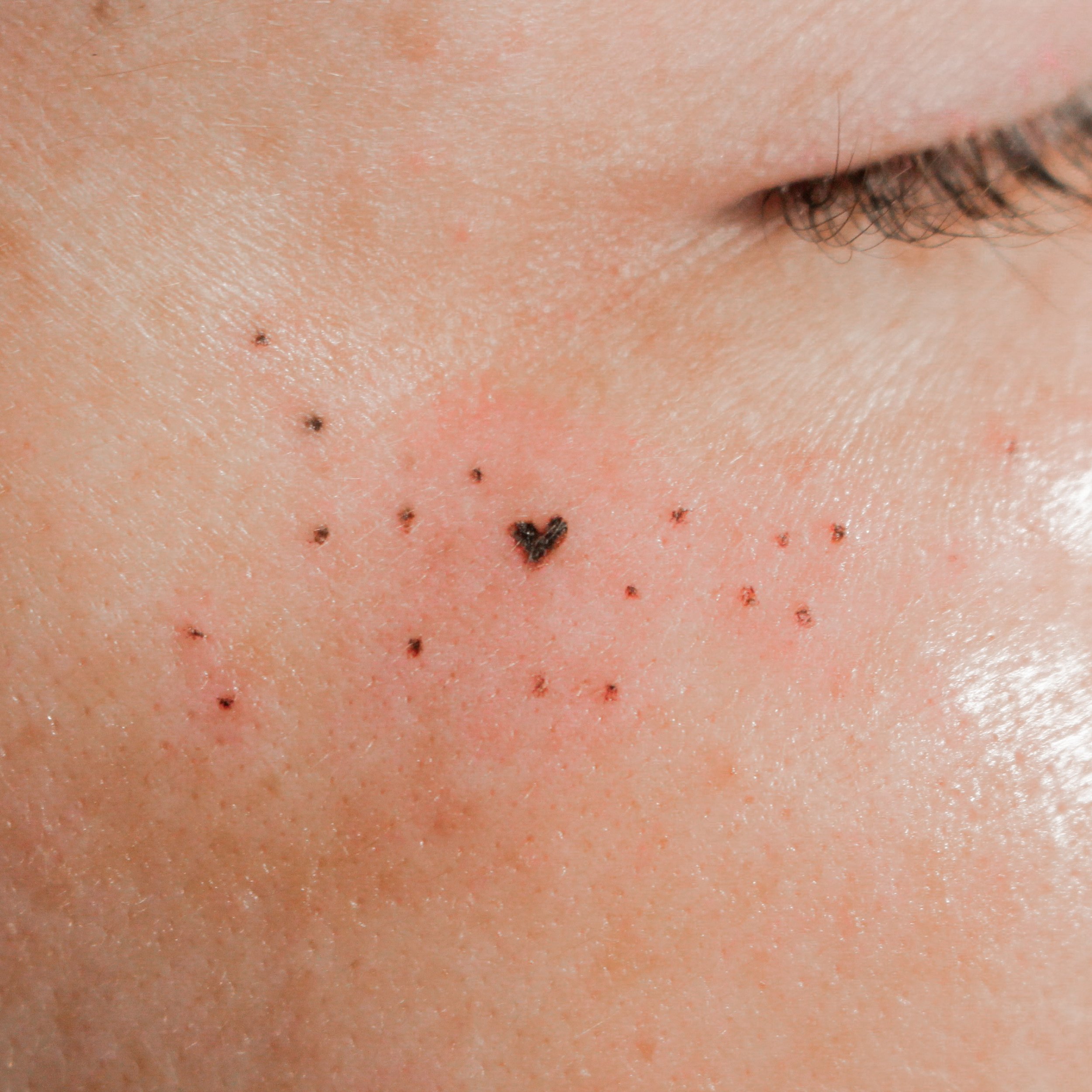 natural freckle tattoo with beauty mark