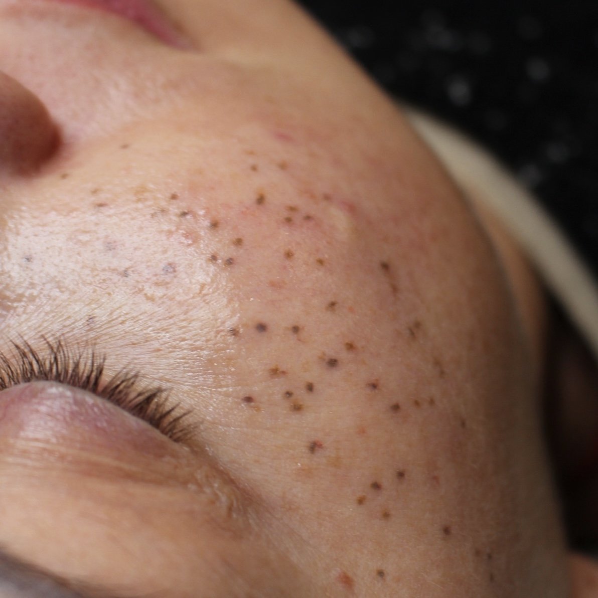 Sun-kissed freckle tattoo