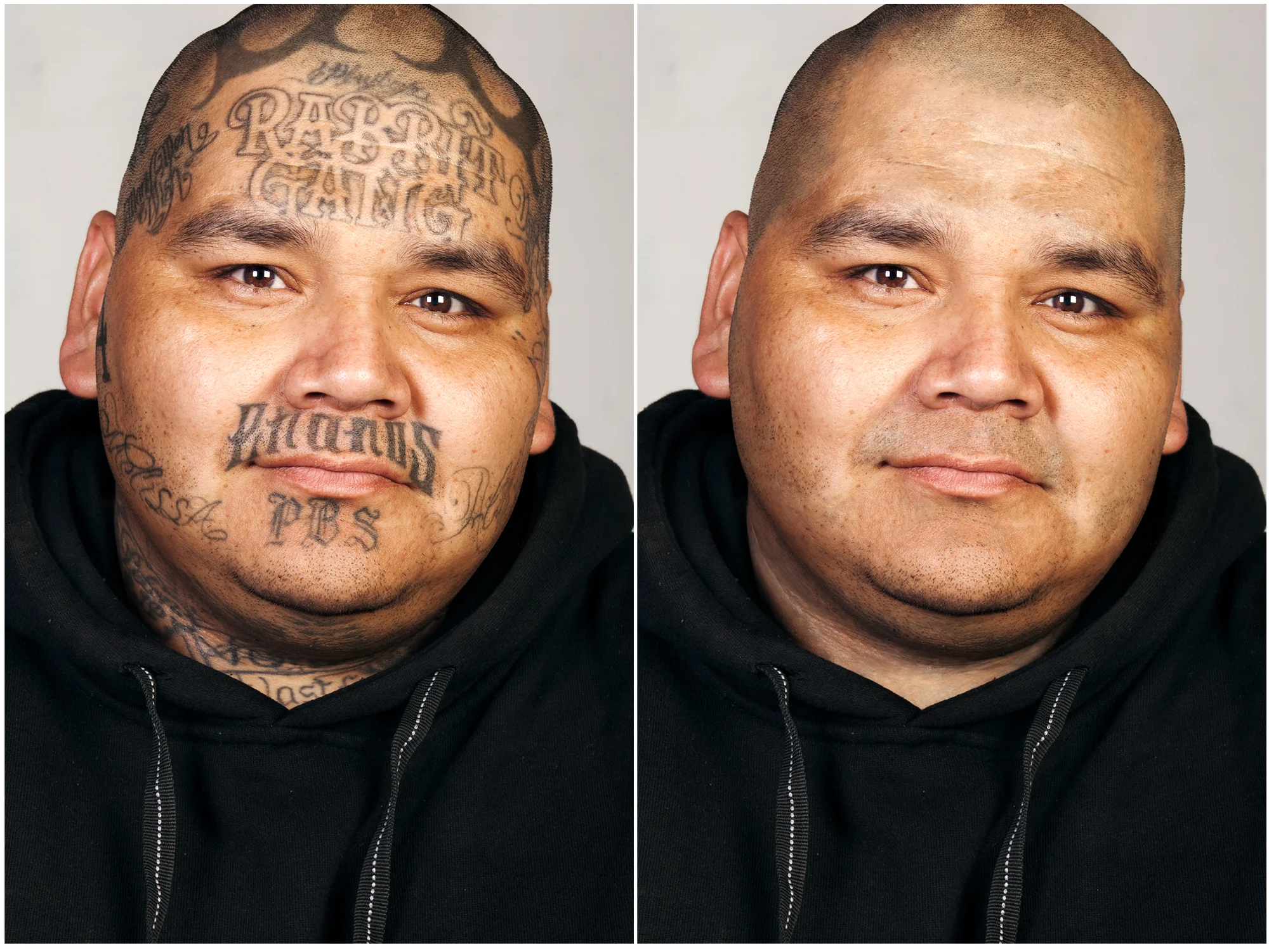 Skin-Deep_Calvin-Hastings_Steven-Burton.jpg