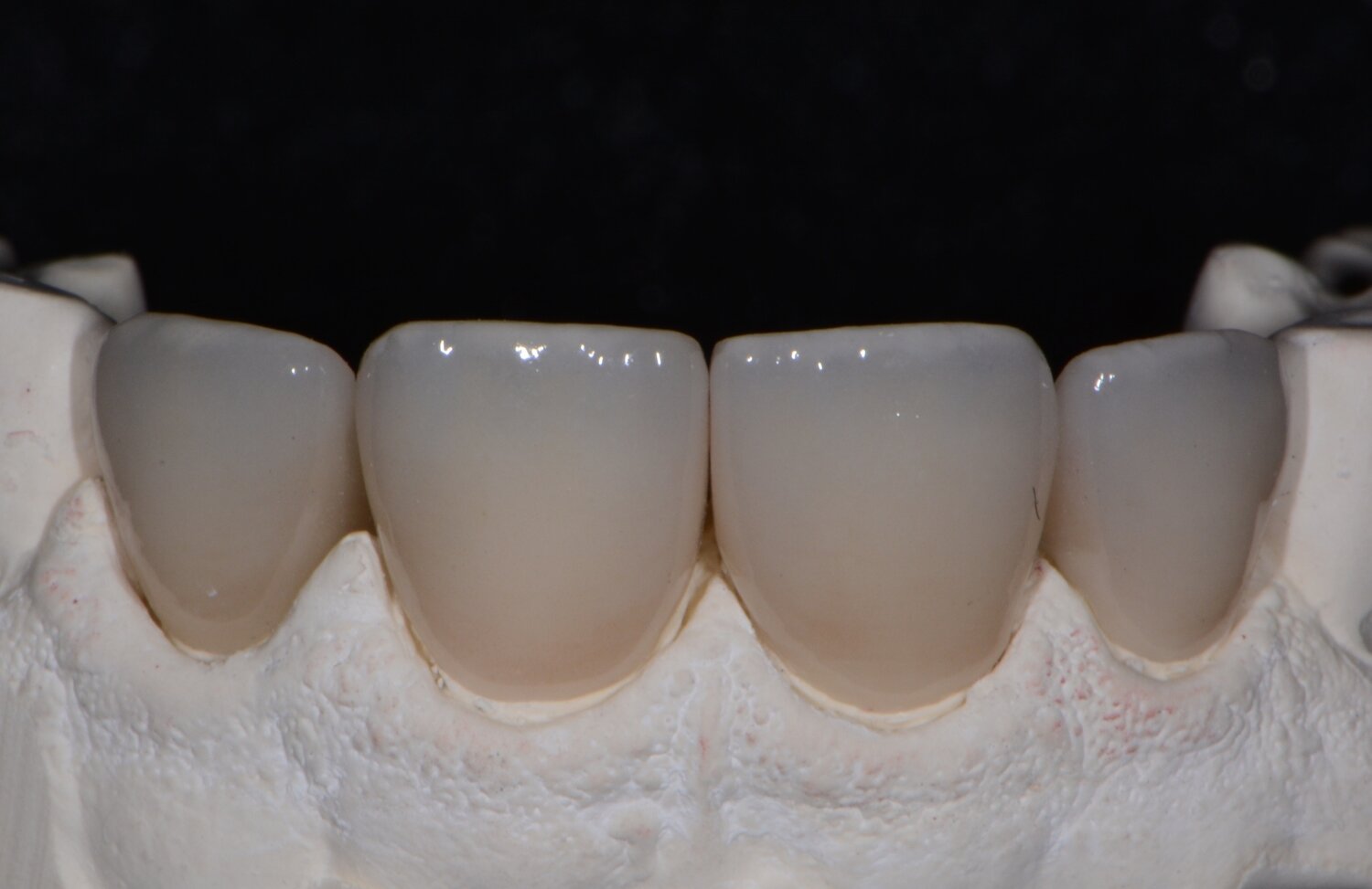 JTL Dental LabJTL Dental Lab