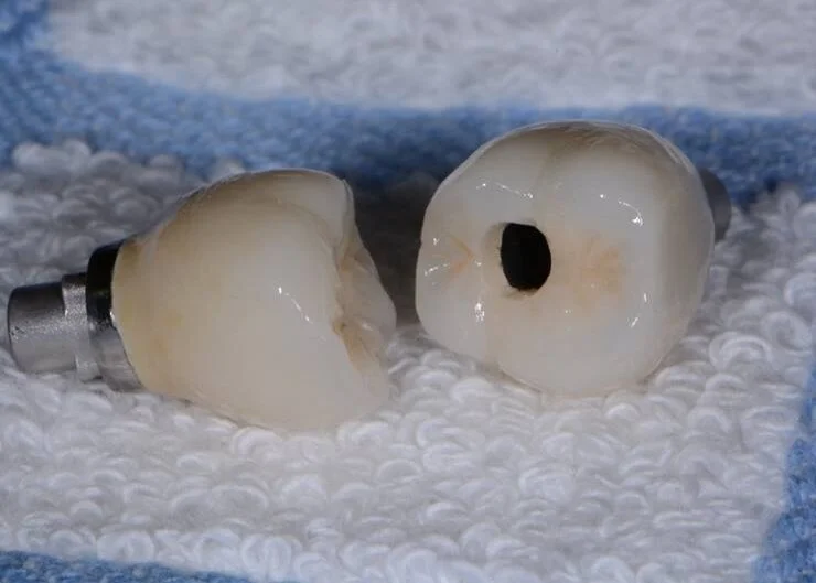 JTL Dental LabJTL Dental Lab