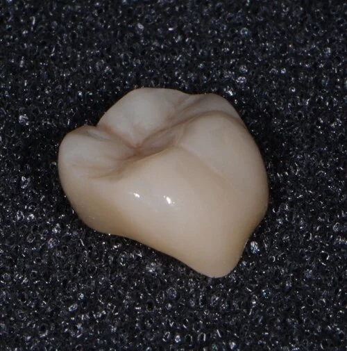 JTL Dental LabJTL Dental Lab