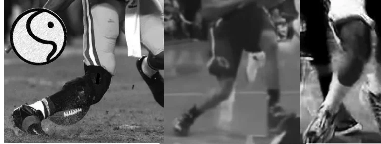 Valgus Loading™ and ACL Injury Prevention