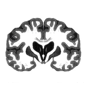 brain bw.jpg