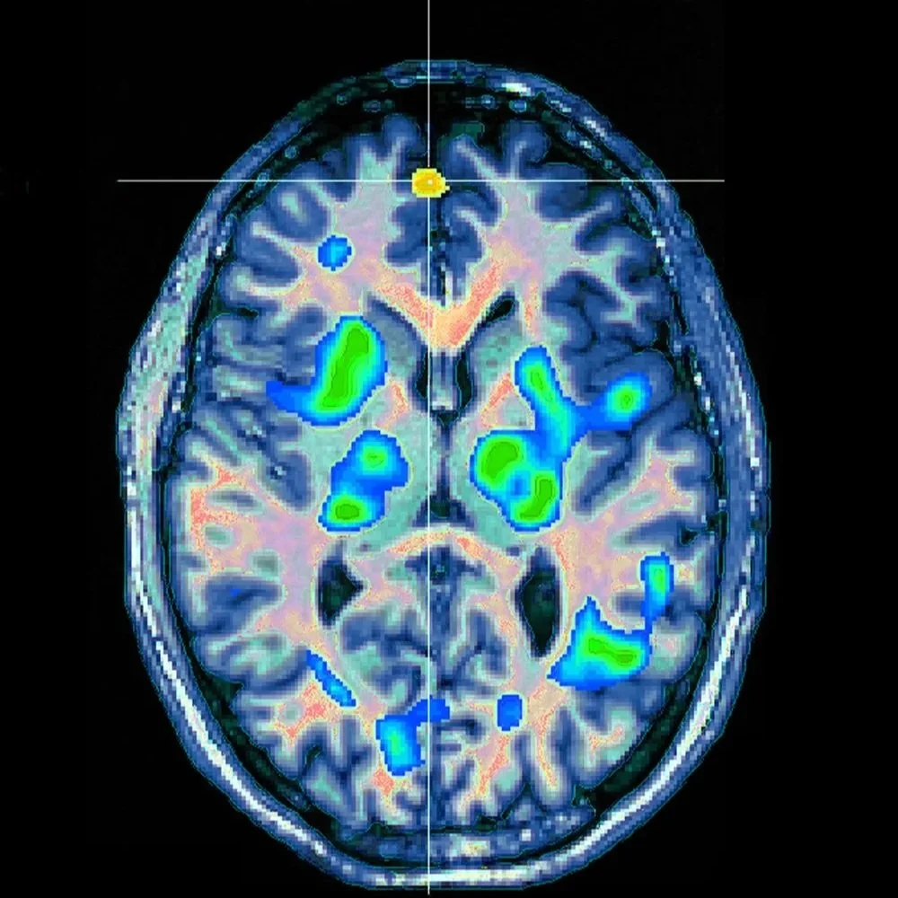 Quando uno spazio diventa un bel ricordo.