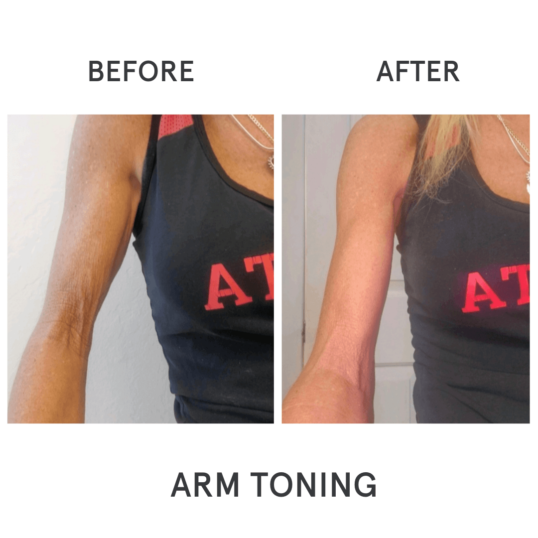 Arm-Toning-BA.png