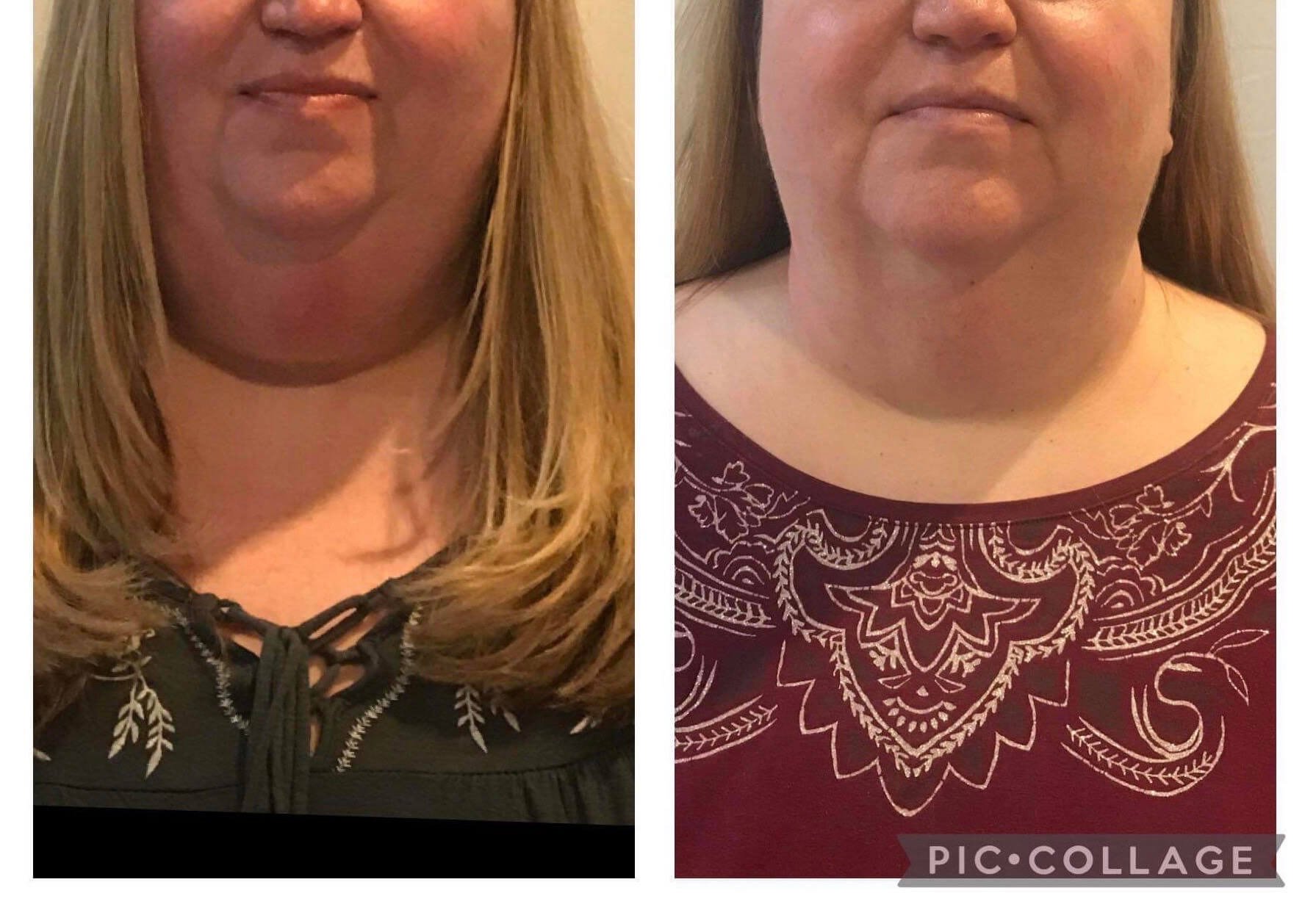 Double-Chin-4-slimming-1-toning.jpg