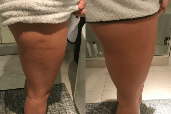 Leg-Toning-Before-After.png