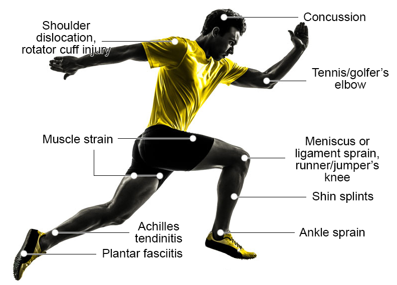 Understanding Common Sports Injuries: Prevention and Treatment Tips