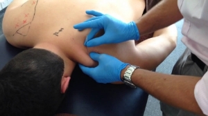 Another soft tissue treatment modality we offer at On Track Physical Therapy is Dry Needling .
