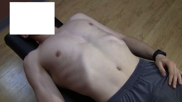 Yes, the position of your ribs matter!