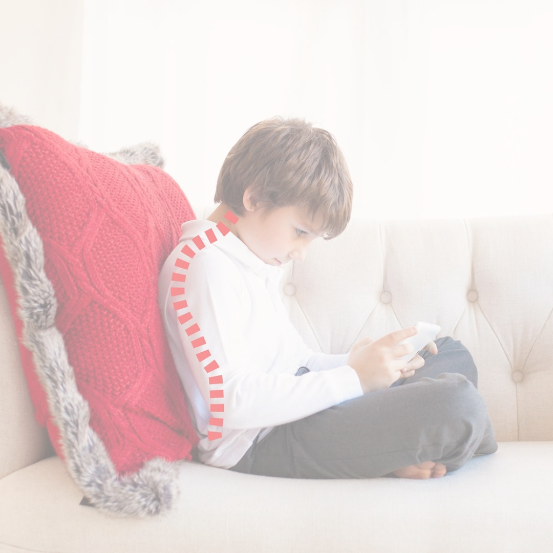 Forward Head Posture